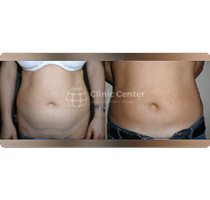 Slider image (4) Clinic Center